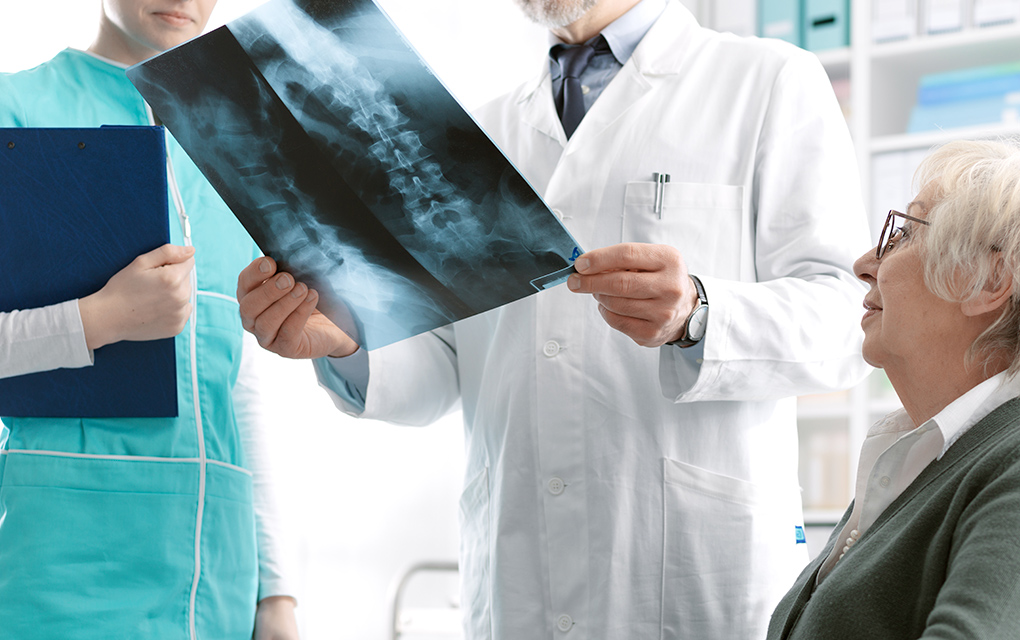 Durante 2018 se registraron más de 220 mil fracturas por osteoporosis 