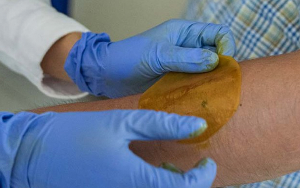 UNAM crea parche para regenerar la piel de las personas diabéticas / Especial
