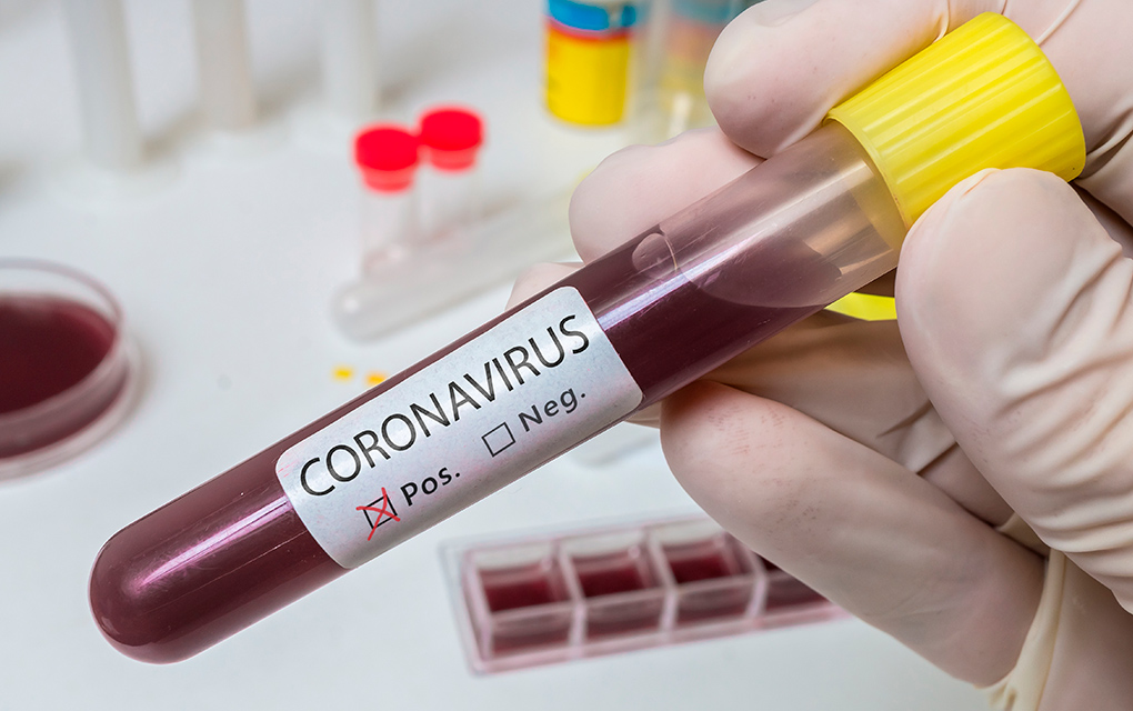 Ya me informé y presento síntomas de coronavirus, ¿qué hago?