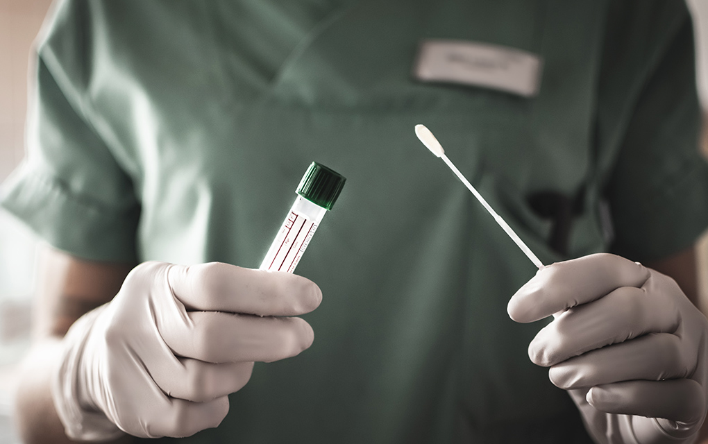 EEUU aprueba primer test de saliva para diagnosticar el virus