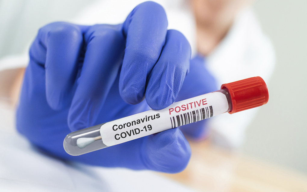 Desde China llegarán 300,000 pruebas para coronavirus