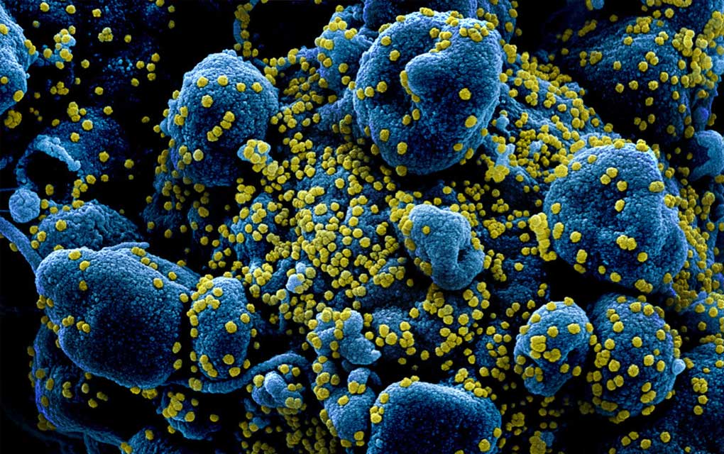Nueva prueba de coronavirus abre puerta a aplicación en masa