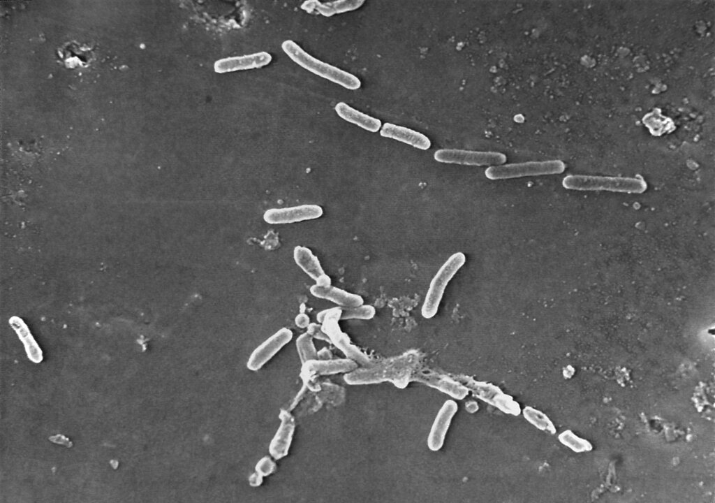 Las “superbacterias” se han unido a las filas de las principales enfermedades infecciosas asesinas del mundo. (AP)