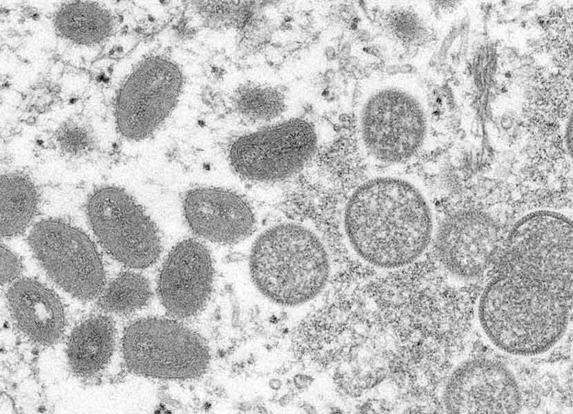 Imagen de microscopio electrónico dada a conocer por los Centros para el Control y la Prevención de las Enfermedades muestra el virus de la viruela símica. / Foto: AP