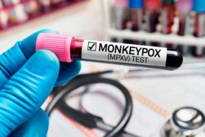 La Secretaría de Salud refuerza vigilancia contra la viruela del mono