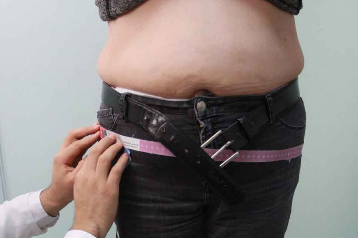 Especialistas recomiendan revisiones anuales para evitar o combatir la obesidad. / Foto: Cuartoscuro