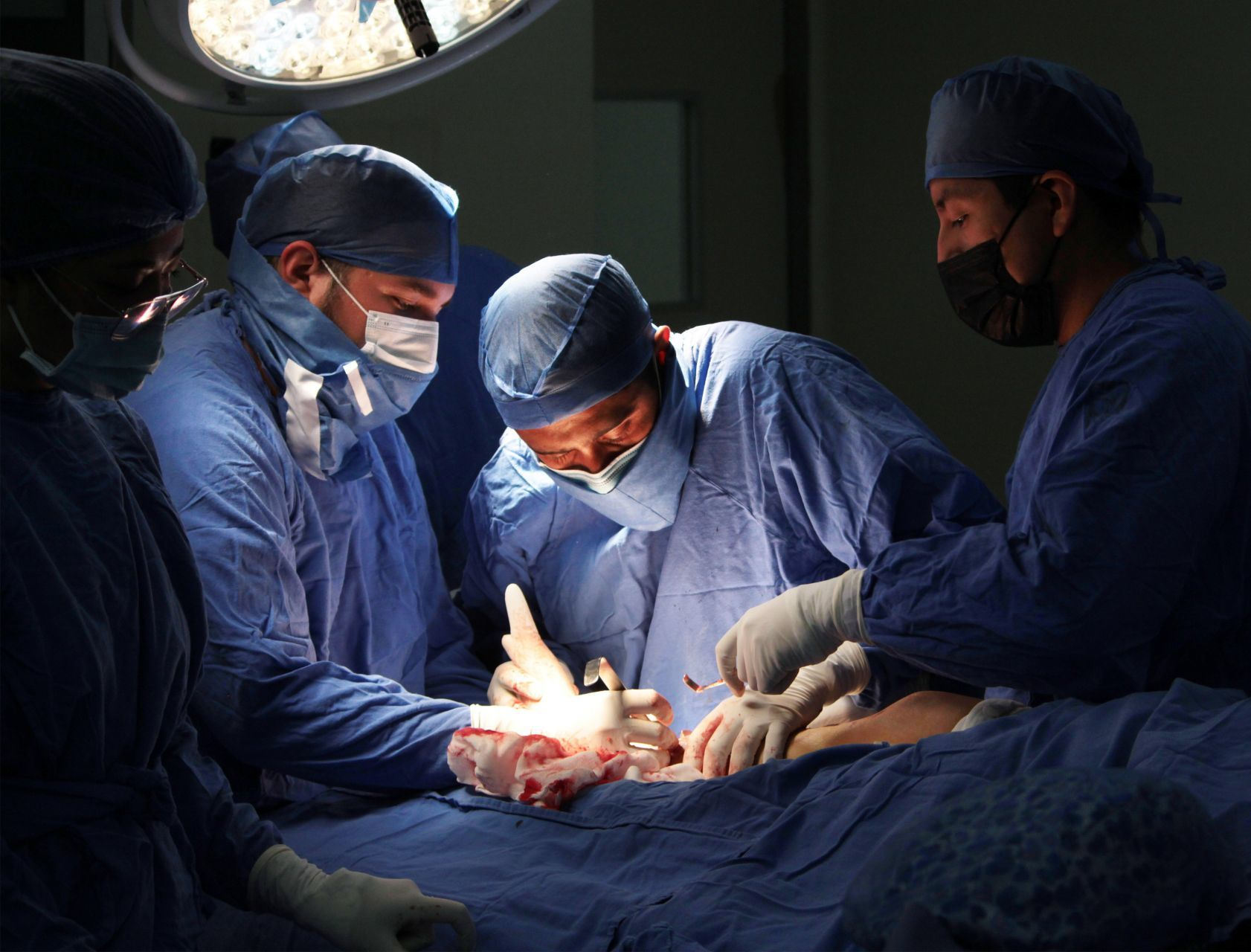 579 personas esperan un trasplante de órgano/Foto: Cuartoscuro