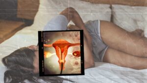 La endometriosis la padecen 190 millones de mujeres y niñas en edad reproductiva en todo el mundo, según la OMS.